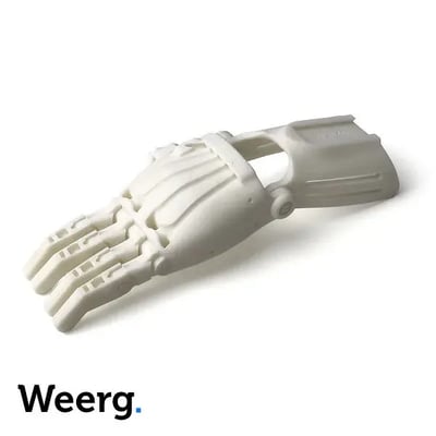 3d-gedruckte medizinische abs-prothese von weerg